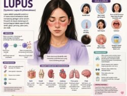 Saat Lupus Datang Tanpa Wajah Jelas, Jakarta Perkuat Deteksi Dini untuk Selamatkan Pasien